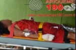 Ariquemes: Mulher leva vários golpes de facão no Setor 09 