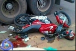 Cacoal: Motociclista tem perna dilacerada por pneu de carreta na BR–364 – Imagens Fortes