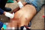 PORTO VELHO: Homem é atacado com facada no peito em bar na região central