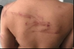 ABSURDO: Criança é agredida com facão pelo pai por perder a chave de casa