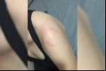 NA MUDANÇA: Mulher é agredida com socos e mordidas pelo ex–marido